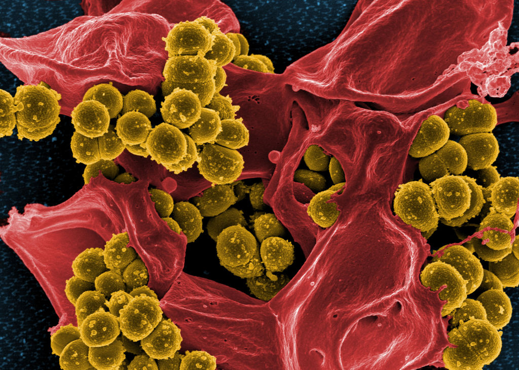 An end to antibiotics?