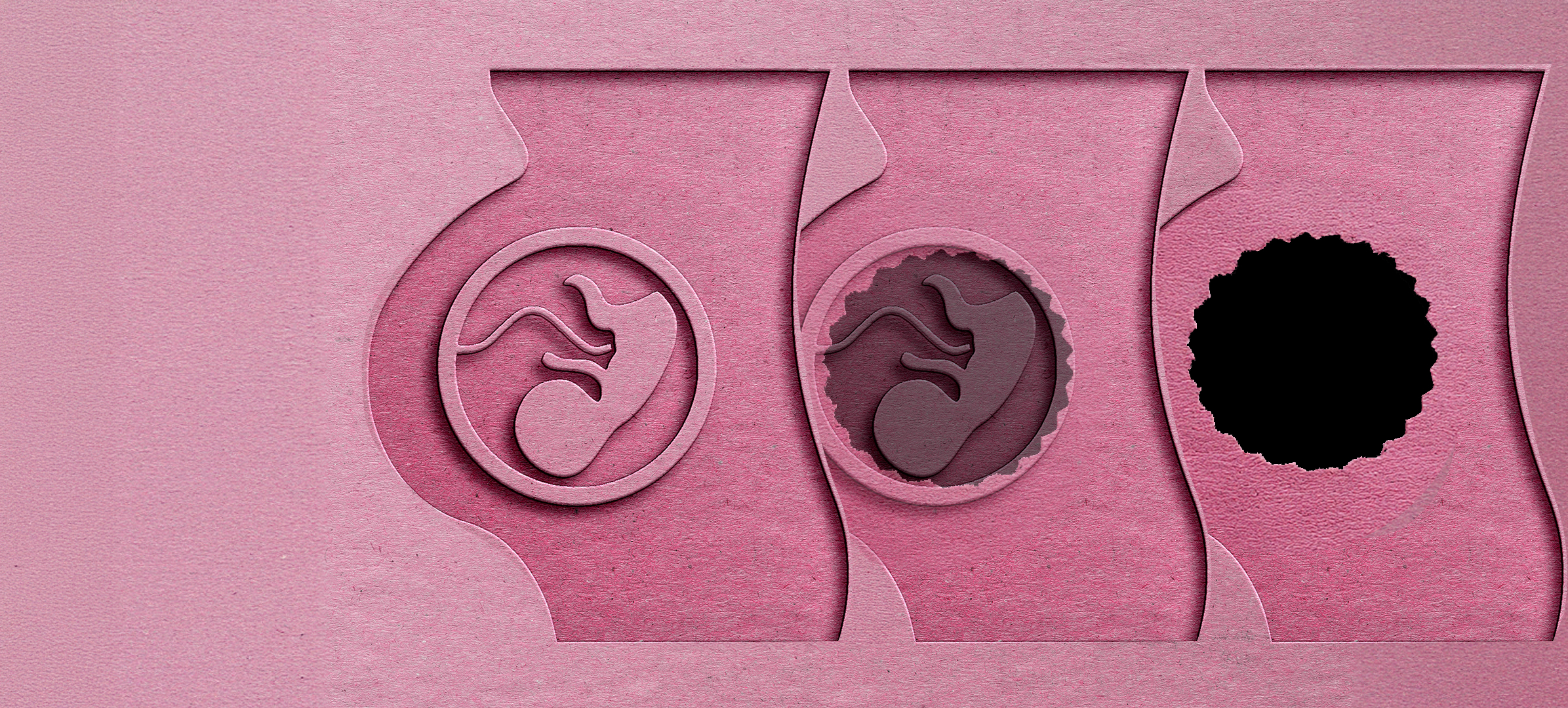 How abortion up to birth was agreed so easily